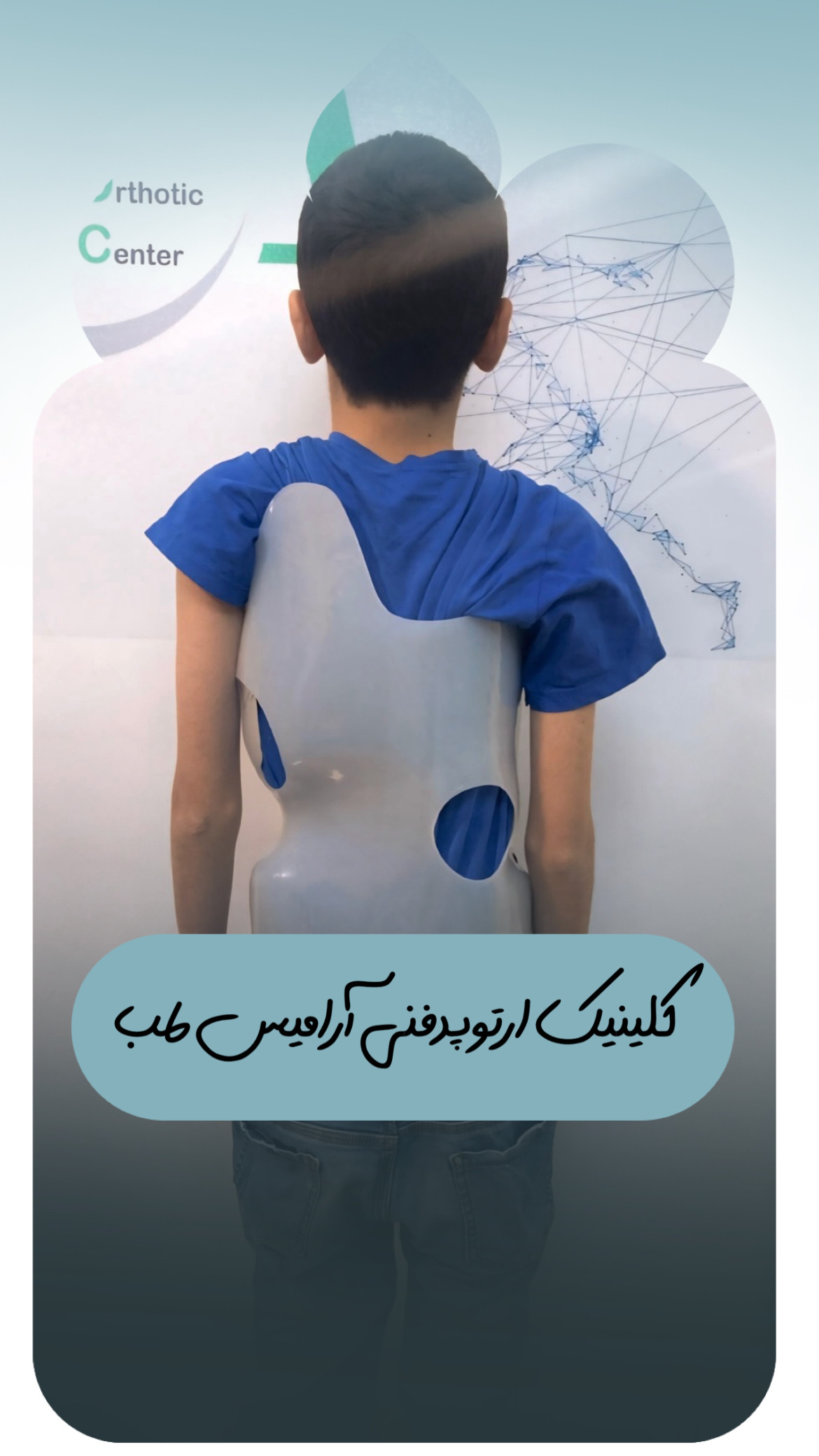 درمان انحراف ستون فقرات