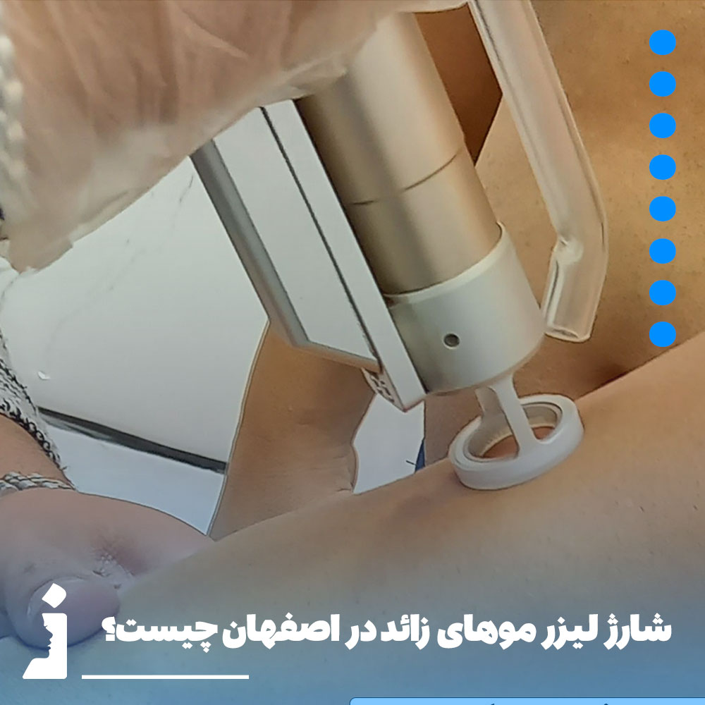 شارژ لیزر موهای زائد در اصفهان چیست؟ چه زمانی به جلسات نگهدارنده لیزر نیاز داریم؟